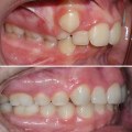 Quando il sorriso costa caro: malasanità odontoiatrica e diritto al risarcimento
