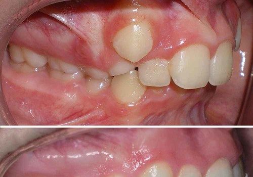 Quando il sorriso costa caro: malasanità odontoiatrica e diritto al risarcimento